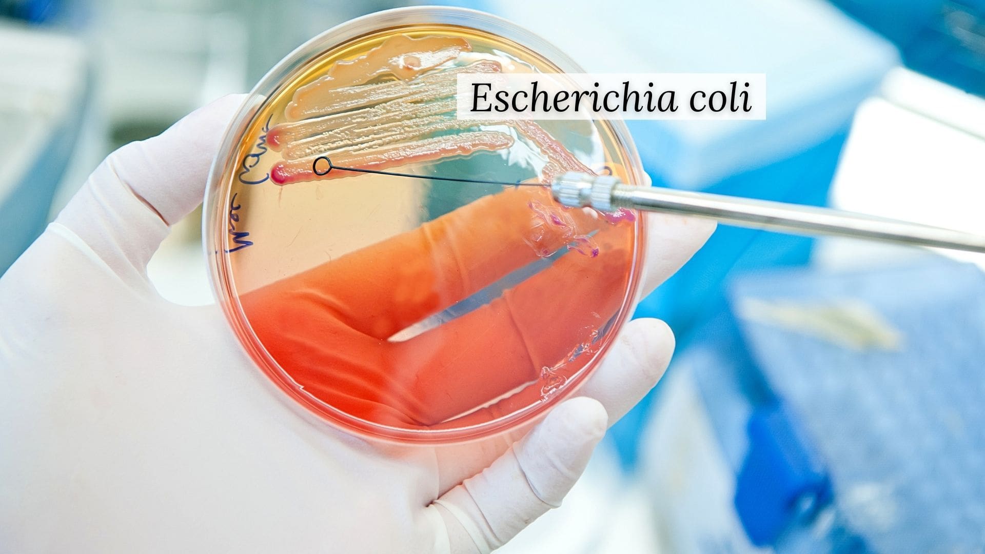 Escherichia coli: tutto ciò che devi sapere | Dimann